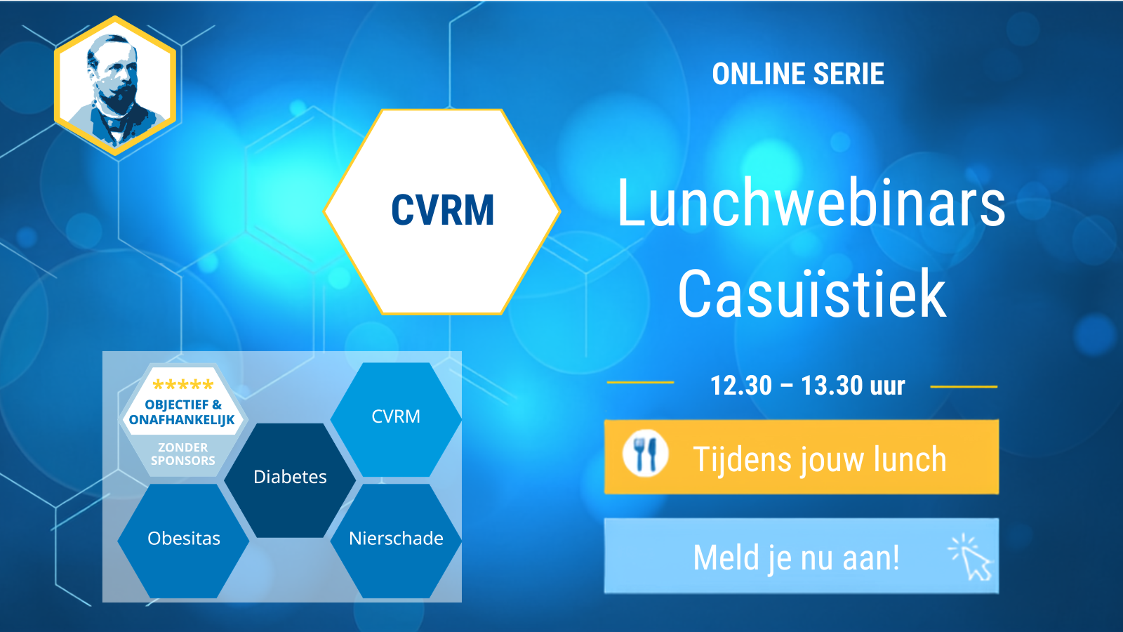 Lunchwebinar CVRM